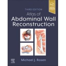 Atlas of Abdominal Wall Reconstruction