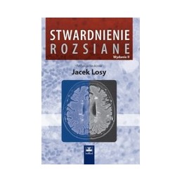 Stwardnienie rozsiane