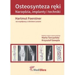 Osteosynteza ręki
