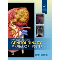 Diagnostic Imaging: Genitourinary