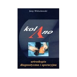 Kolano - artroskopia diagnostyczna i operacyjna
