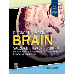 Diagnostic Imaging: Brain