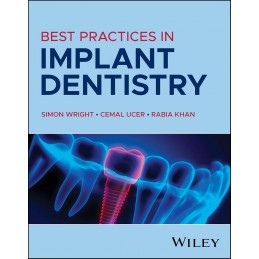 Best Practices in Implant...