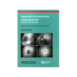 Angiografia fluoresceinowa...