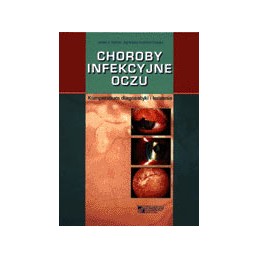 Choroby infekcyjne oczu