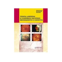 Terapia laserowa w chorobach siatkówki niezwiązanych z cukrzycą