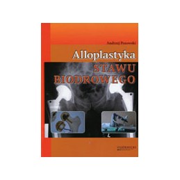 Alloplastyka stawu biodrowego