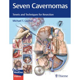 Seven Cavernomas: Tenets...