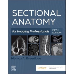 Sectional Anatomy for...