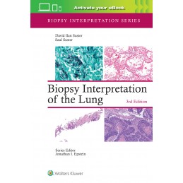 Biopsy Interpretation of the Lung: Print + digital version with Multimedia