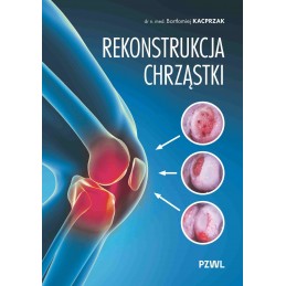 Rekonstrukcja chrząstki