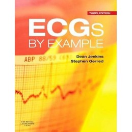 ECGs by Example