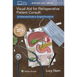 Visual Aid for Perioperative Patient Consult: An Illustrated Guide to Surgical Procedures