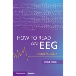 How to Read an EEG