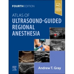 Atlas of Ultrasound-Guided Regional Anesthesia