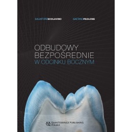 Odbudowy bezpośrednie w...