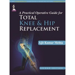 A Practical Operative Guide for Total Knee and Hip Replacement