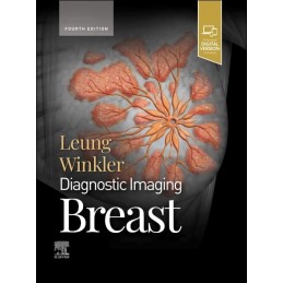 Diagnostic Imaging: Breast