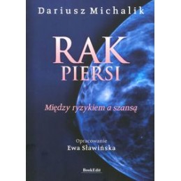 Rak piersi. Między ryzykiem...