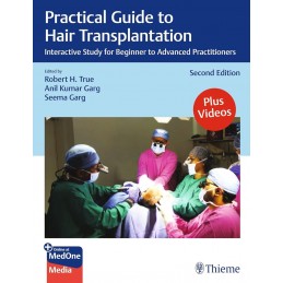 Practical Guide to Hair Transplantation: Interactive Study for the Beginning Practitioner