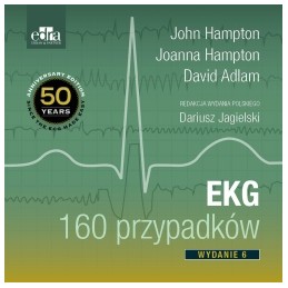 EKG 160 przypadków