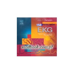 150 problemów EKG