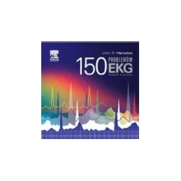 150 problemów EKG