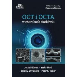 OCT I OCTA w chorobach...