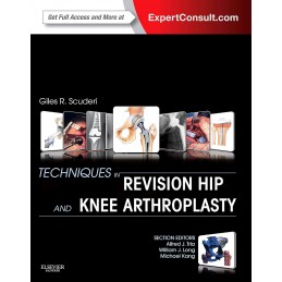 Techniques in Revision Hip...