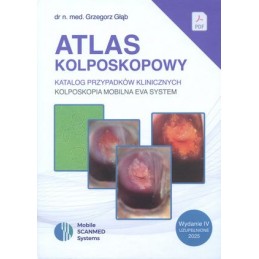 Atlas kolposkopowy - katalog przypadków klinicznych