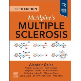 McAlpine's Multiple Sclerosis