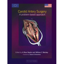 Carotid Artery Surgery