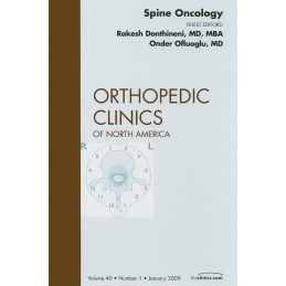 Spine Oncology, An Issue of...