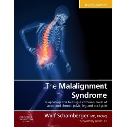 The Malalignment Syndrome