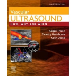 Vascular Ultrasound