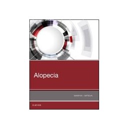Alopecia