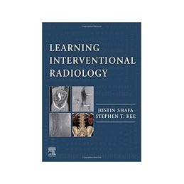 Learning Interventional...