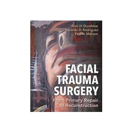 Facial Trauma Surgery