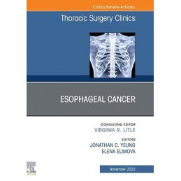 Esophageal Cancer, An Issue...