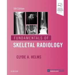 Fundamentals of Skeletal...