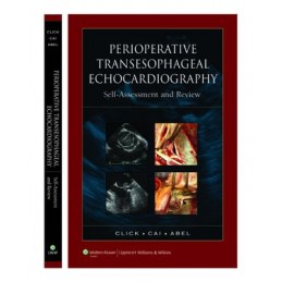 Perioperative Transesophageal Echocardiography Self-Assessment and Review