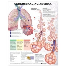 Understanding Asthma Anatomical Chart