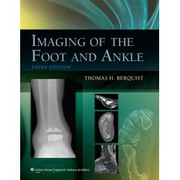 Imaging of the Foot and Ankle