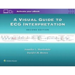 A Visual Guide to ECG...