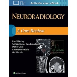 Neuroradiology: A Core Review
