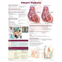 Heart Failure Anatomical Chart