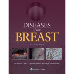 Diseases of the Breast 5e