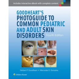 Goodheart's Photoguide to Common Pediatric and Adult Skin Disorders