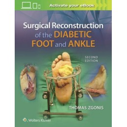 Surgical Reconstruction of the Diabetic Foot and Ankle