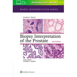Biopsy Interpretation of the Prostate